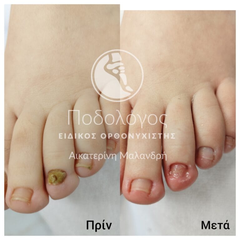 IMG_20240411_182822_334