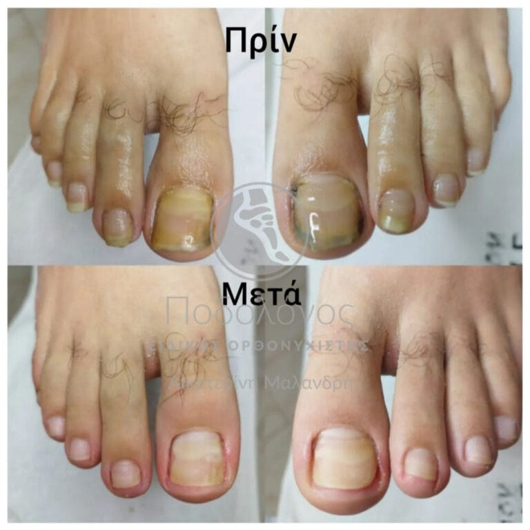 InShot_20240415_191445530