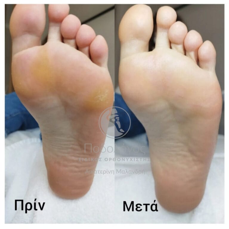 InShot_20240415_191554106