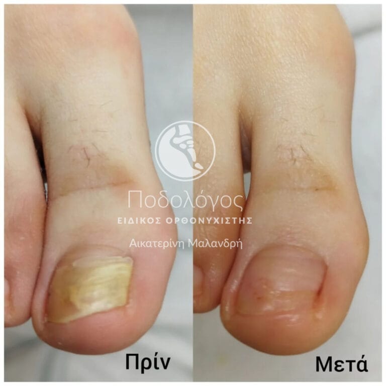 InShot_20240415_191927819