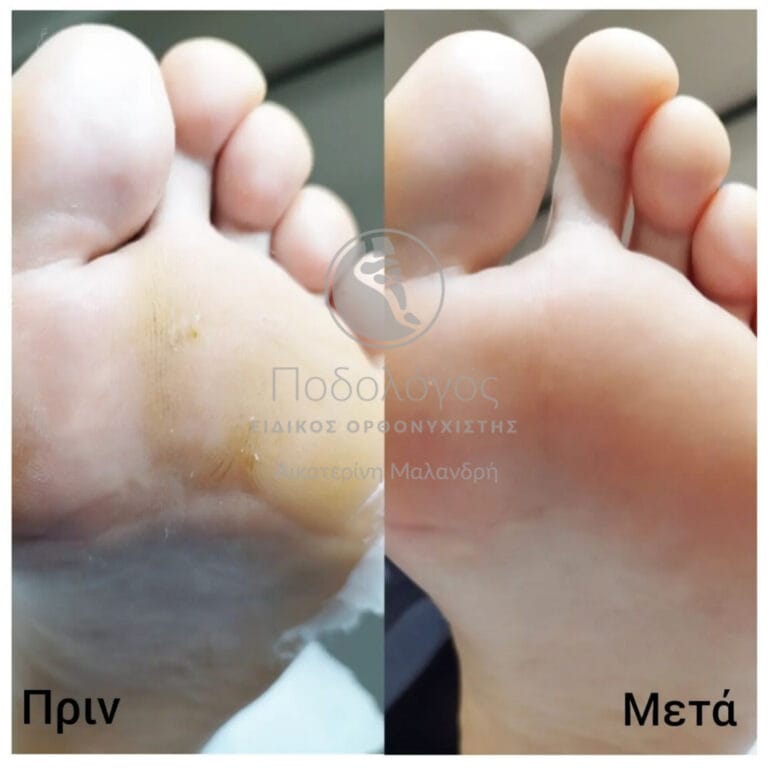 InShot_20240415_192015231