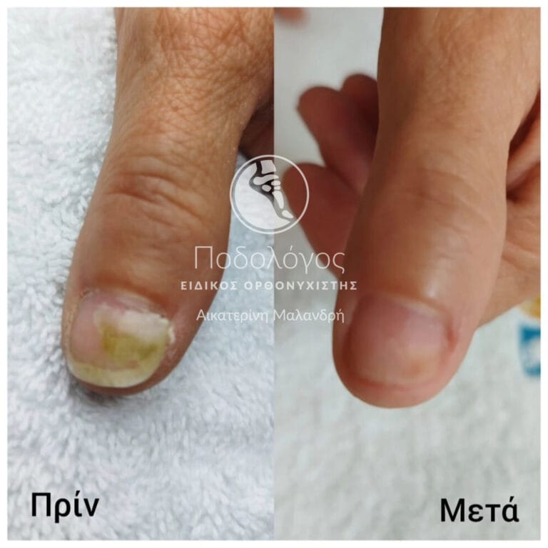 InShot_20240415_192104066