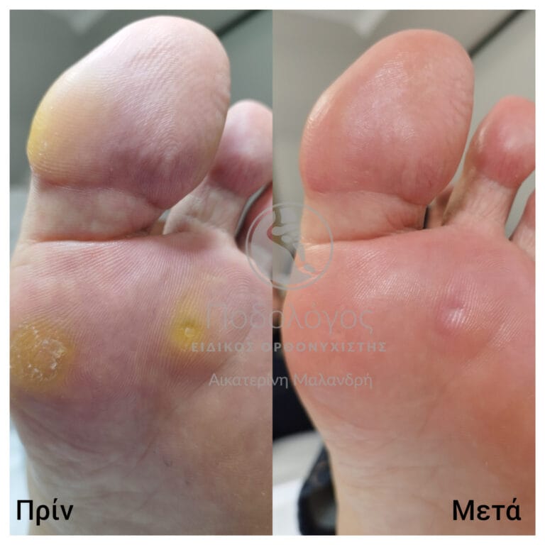 InShot_20240415_192738816