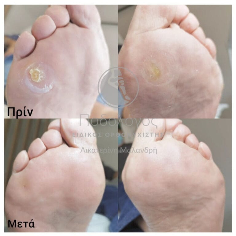 InShot_20240415_193102722