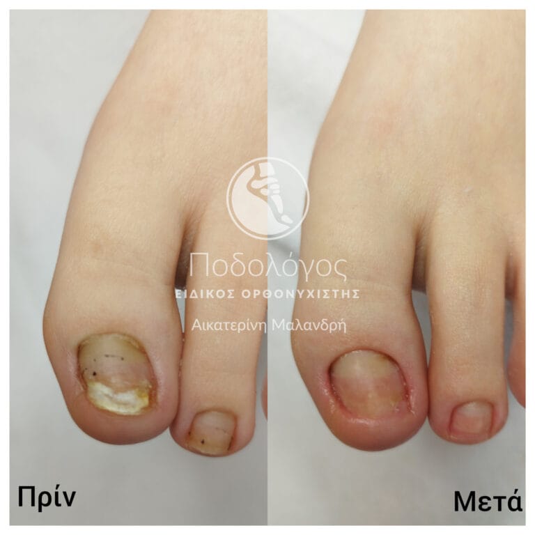 InShot_20240415_193531120