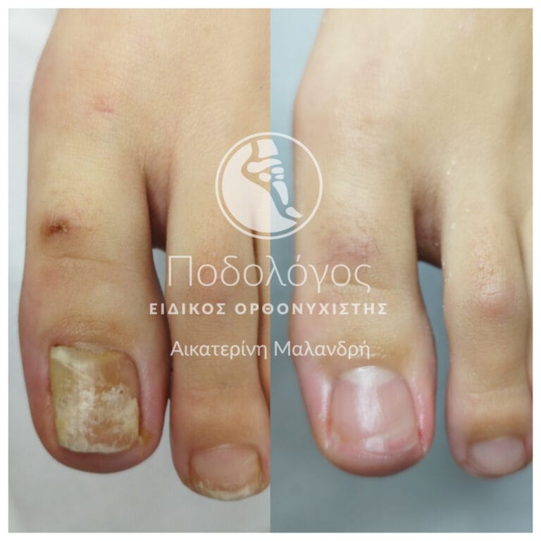 podiatry-medicare Malandri (3)