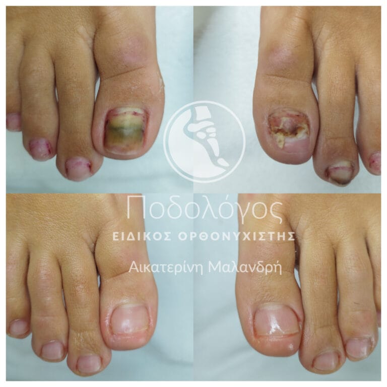 podiatry-medicare Malandri (4)