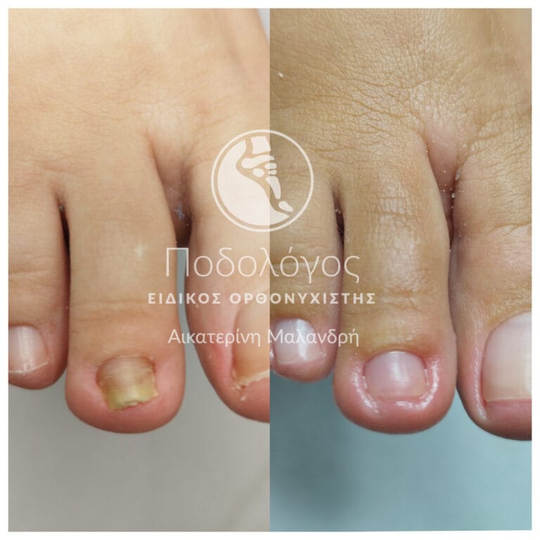 podiatry-medicare Malandri (5)