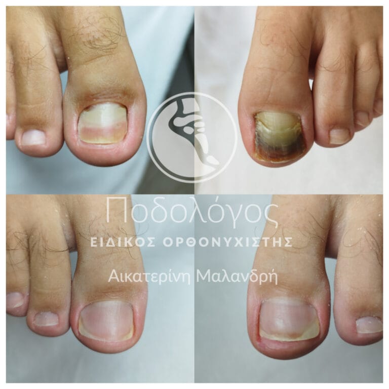 podiatry-medicare Malandri (6)