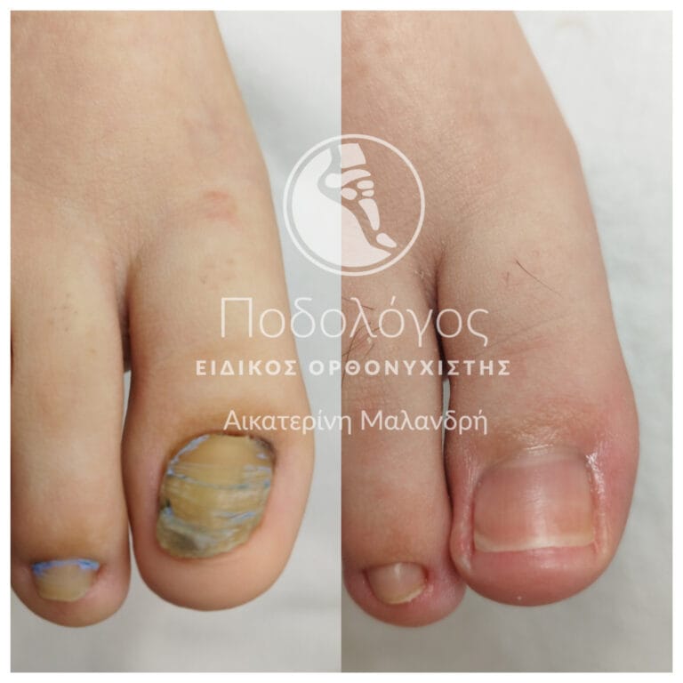 Podiatry Medicare Katerina Malandri